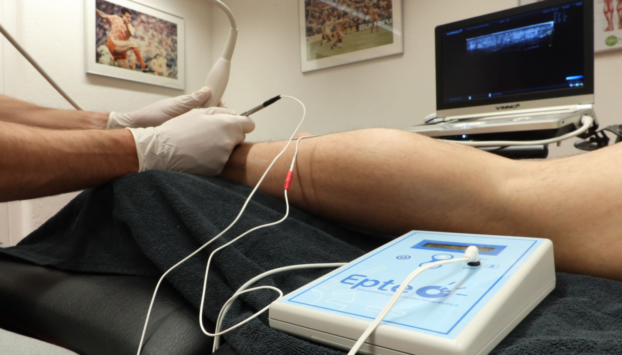 EPTE voor en nadelen